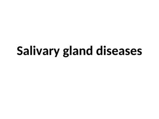 13. Salivary Glands Diseases.pptx
